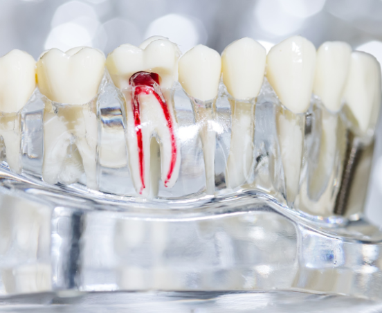 Korzenie zębów a kanały - ile ząb ma korzeni a ile kanałów?