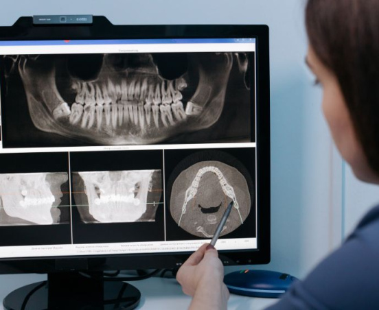 Szkliwiak (ameloblastoma) – co to jest?