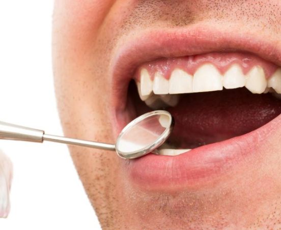 Gingiwektomia – czym jest i kiedy się stosuje?