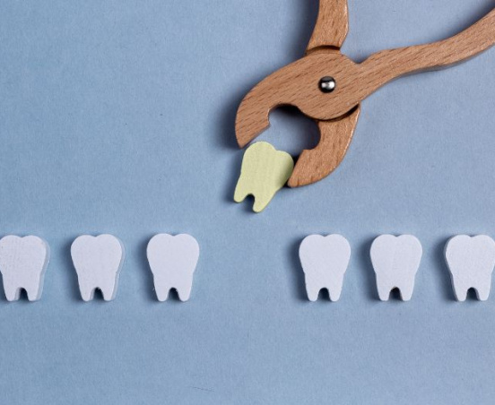 Ekstrakcja zęba – o czym trzeba wiedzieć przed zabiegiem?