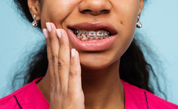 Aparat ortodontyczny a ósemki - czy trzeba wyrywać?