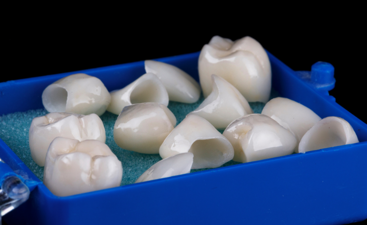 Korony zębowe - czym są i kiedy warto?