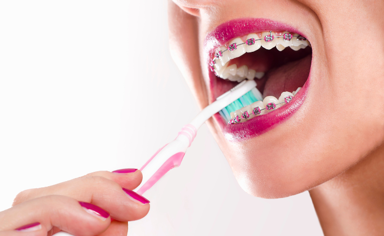 pasta do zębów przy aparacie ortodontycznym