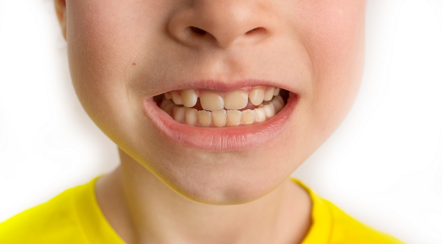 dlaczego mam żółte zęby - uwarunkowania genetyczne